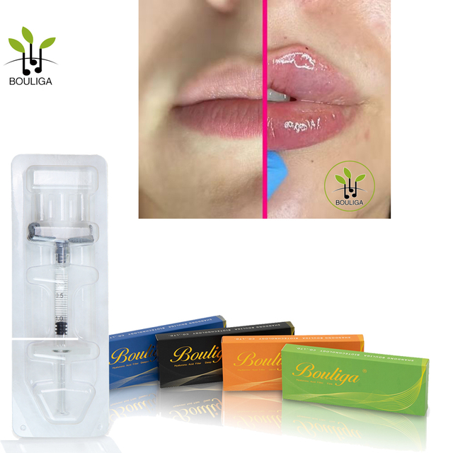 Bouliga Dudak Dolgunlaştırıcı 1ml 2ml 5ml Dermal Dolgu