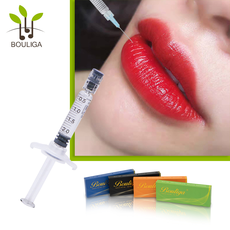 Güzel Dudaklar için Bouliga Dermal Dolgu 1ml 2ml 5ml